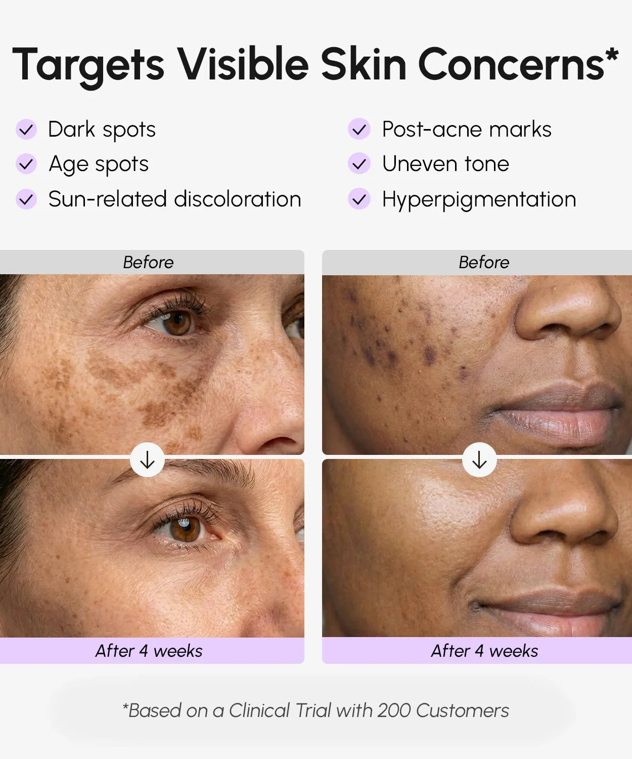 Face & Body Serum for Dark Spots