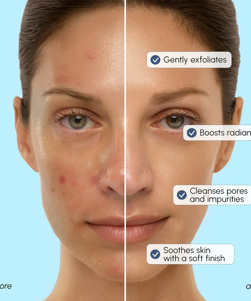 Face Polishing Scrub & Exfoliator