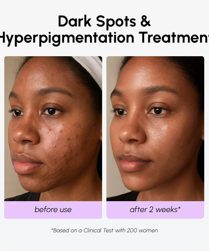 Dark Spot Corrector