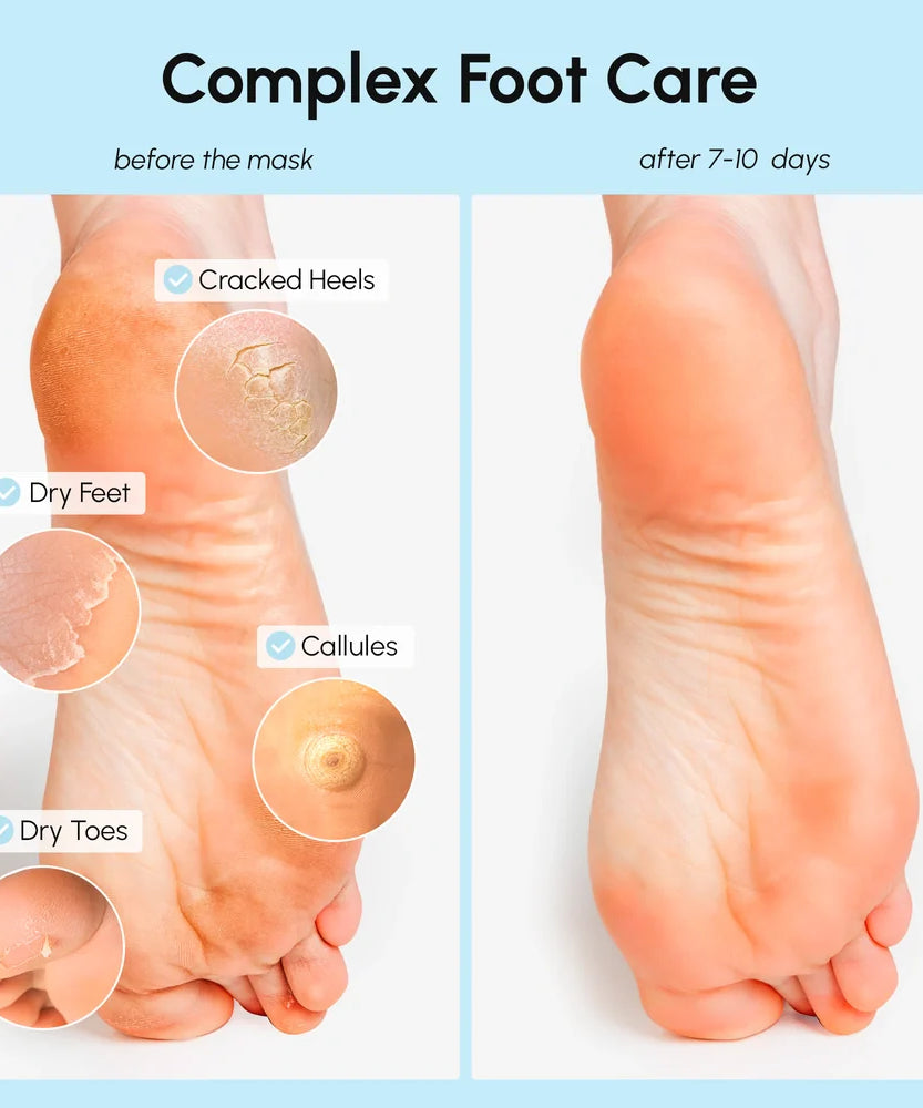 Exfoliating & Hydrating Foot Mask