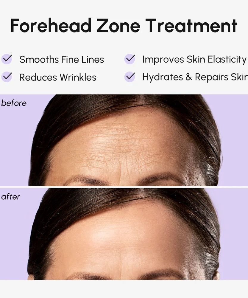 Anti-Wrinkle Forehead Patches