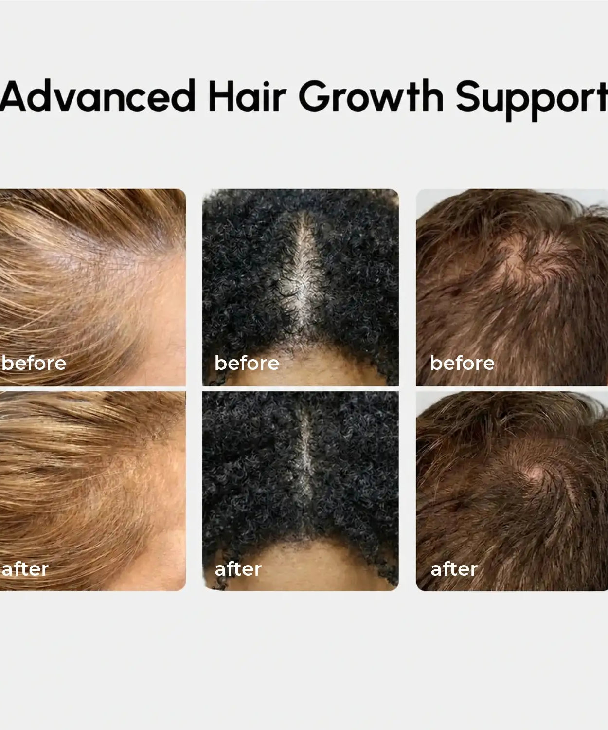 4-in-1 Hair Growth Spray