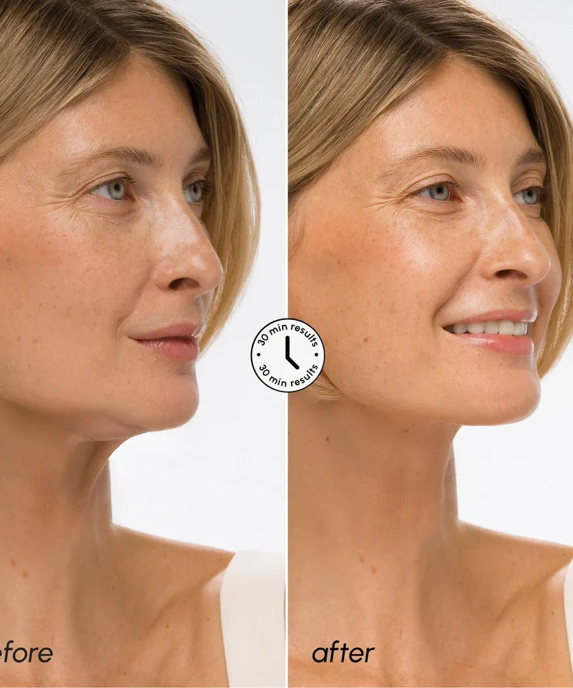 Hyaluronic Acid V-line Lifting Mask