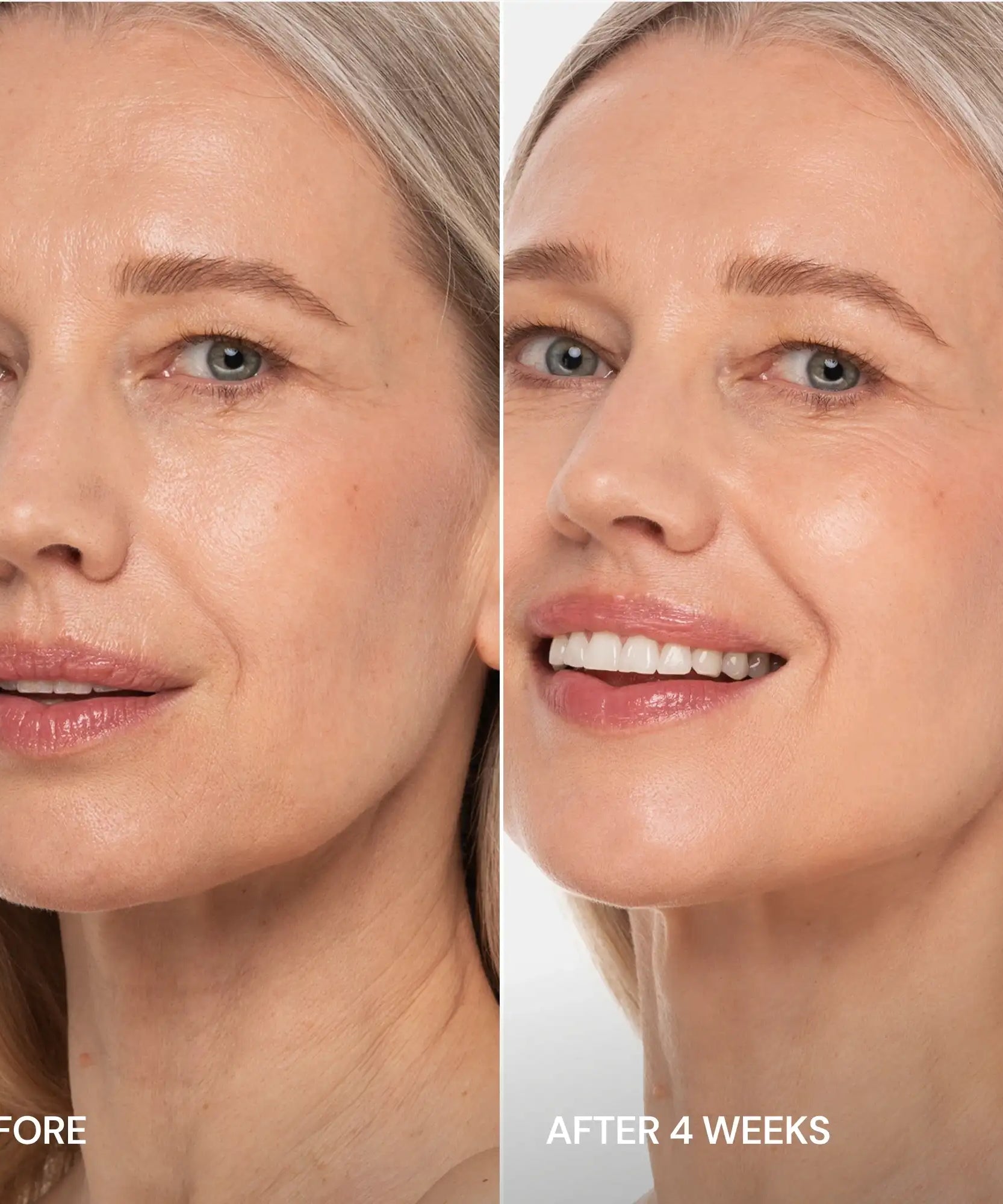 Pro-Retinol Neck Lifting Cream Massager