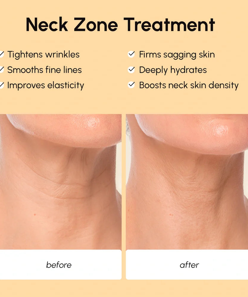 Lifting Neck Wrinkle Patches