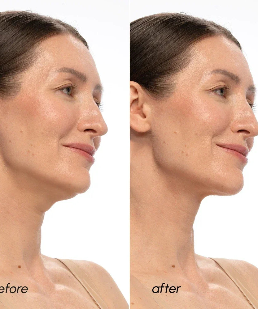 PDRN V-line Lifting Mask