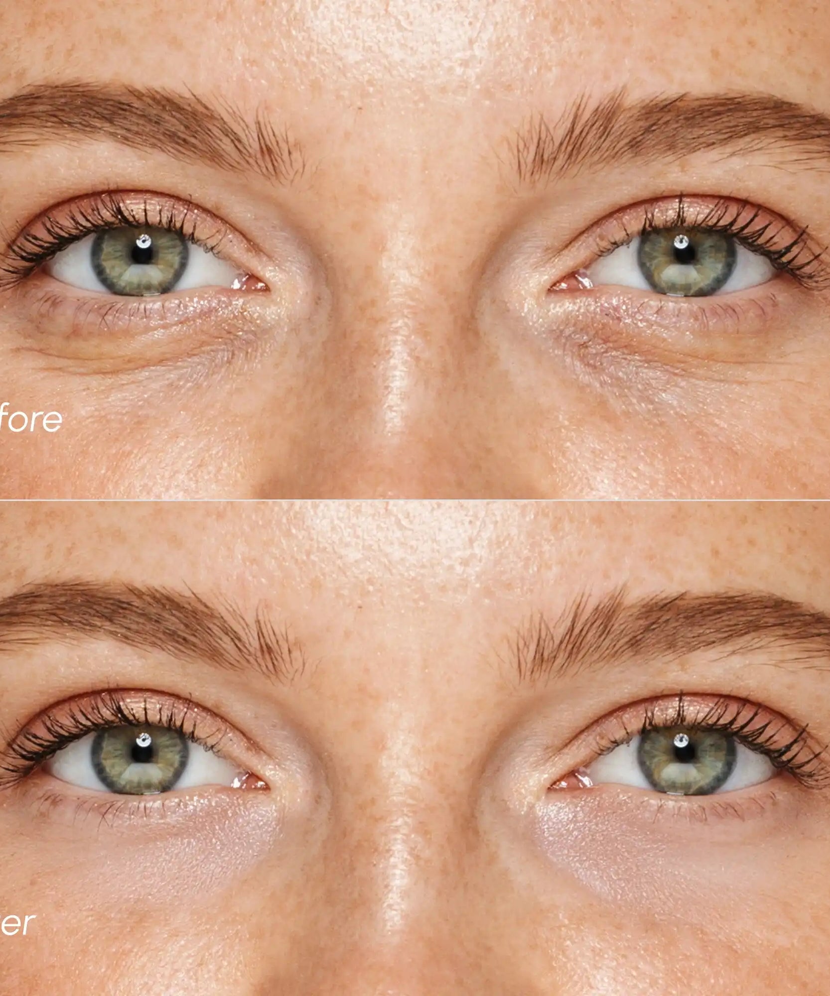 Pink Eye Patches for Puffy Eyes