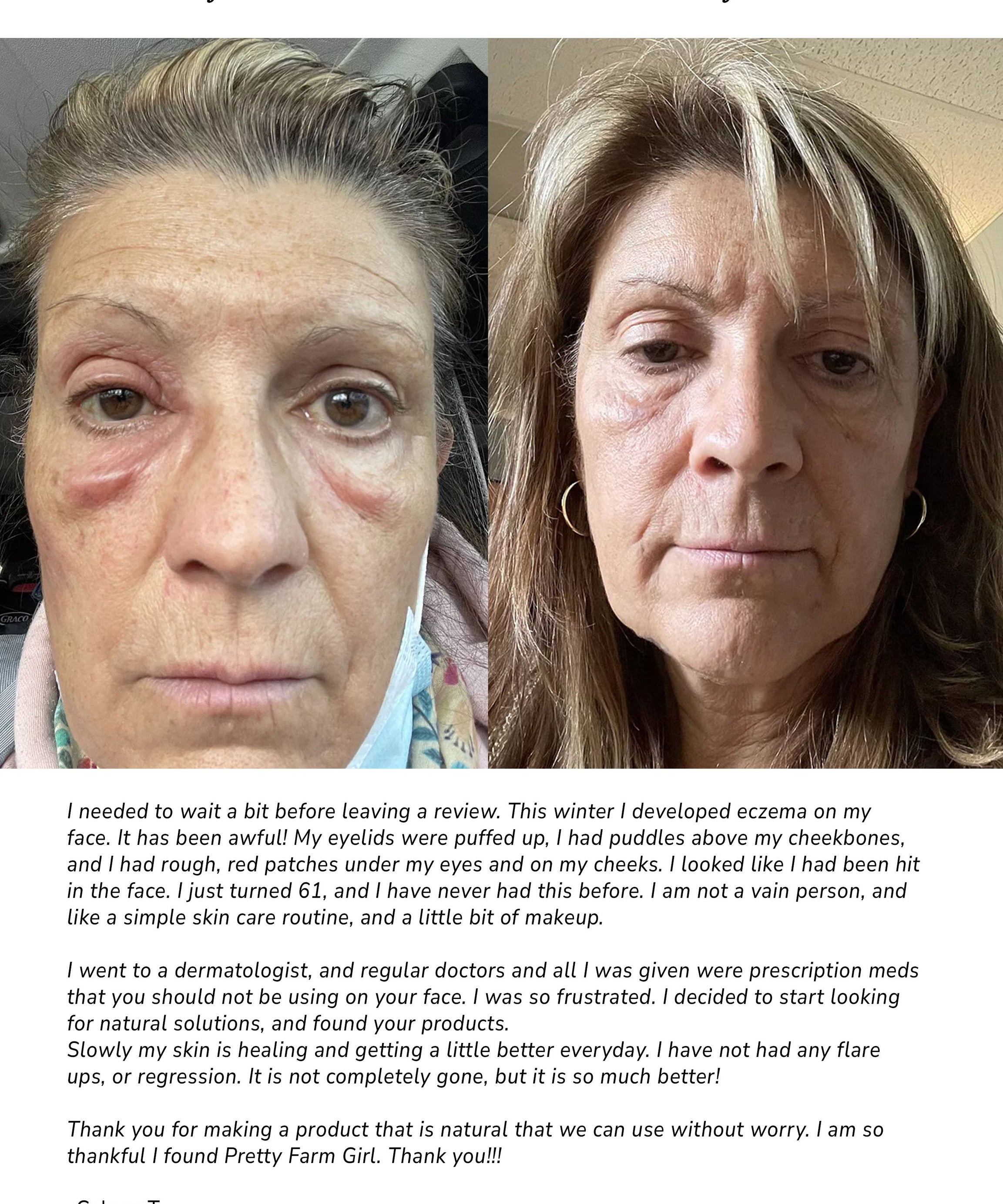Pure + Simple Skin Kit for Sensitive Skin