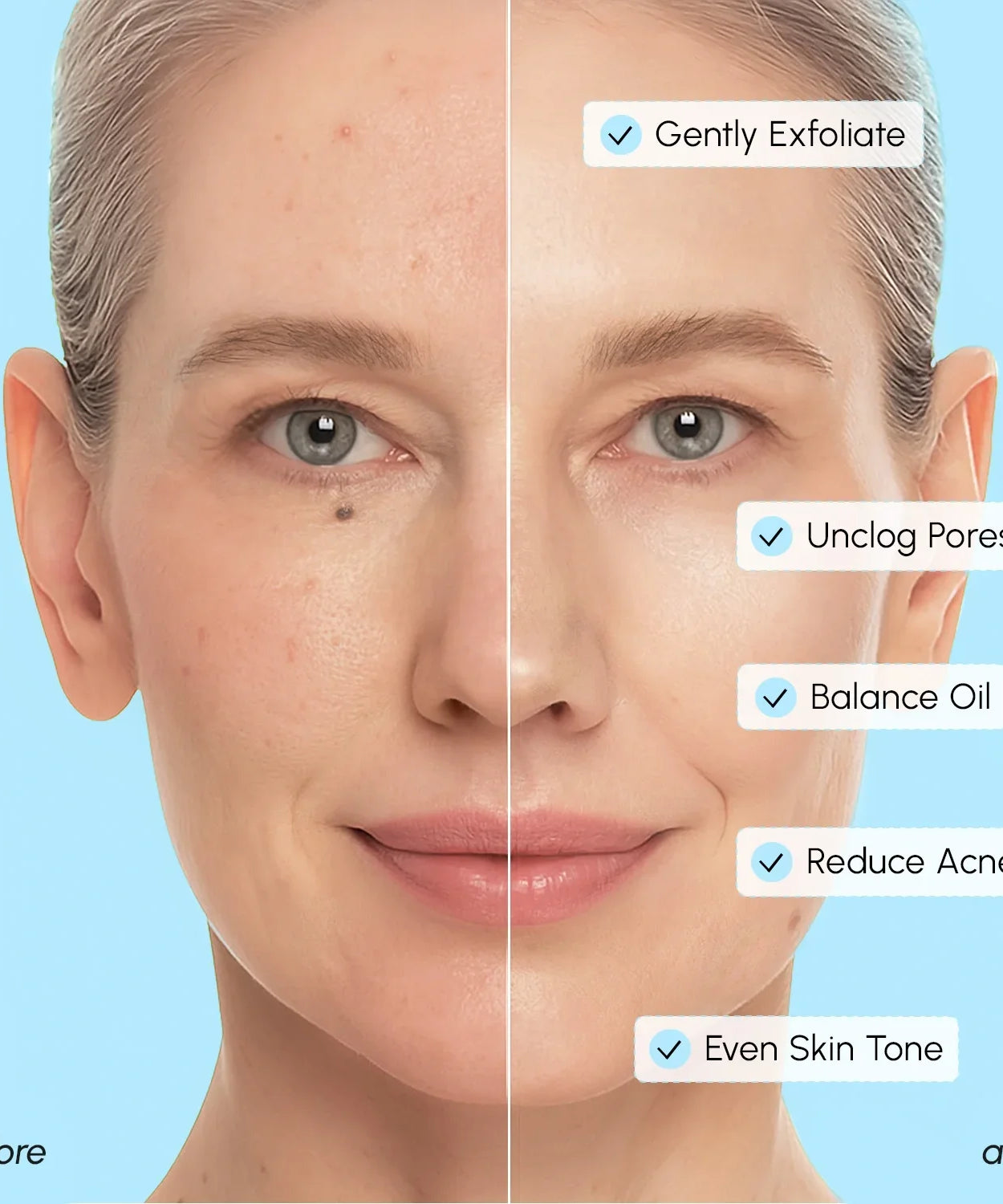 Glycolic & Salicylic Acid Peel Pads