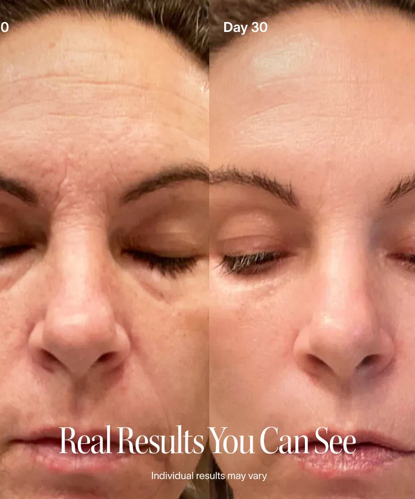 4-in-1 Rotlichttherapie-Stab & Aktivierendes Serum Kit