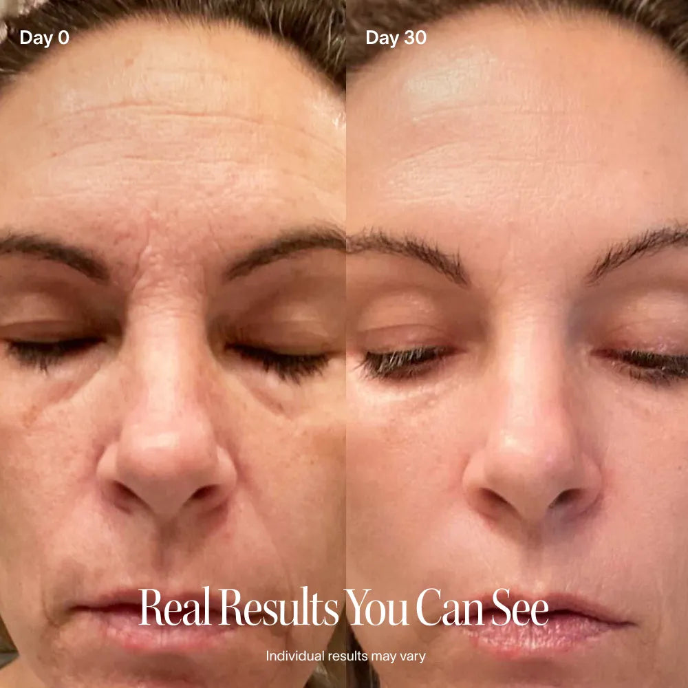 4-in-1 Rotlichttherapie-Stab & Aktivierendes Serum Kit