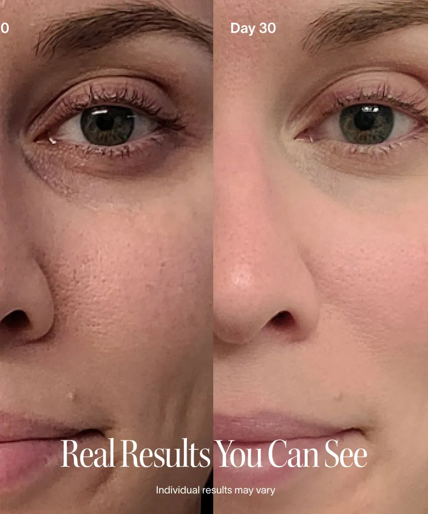 4-in-1 Rotlichttherapie-Stab & Aktivierendes Serum Kit