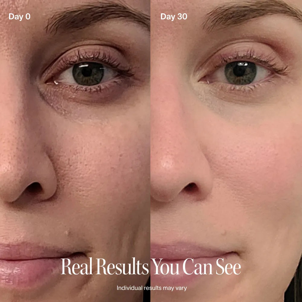 4-in-1 Rotlichttherapie-Stab & Aktivierendes Serum Kit