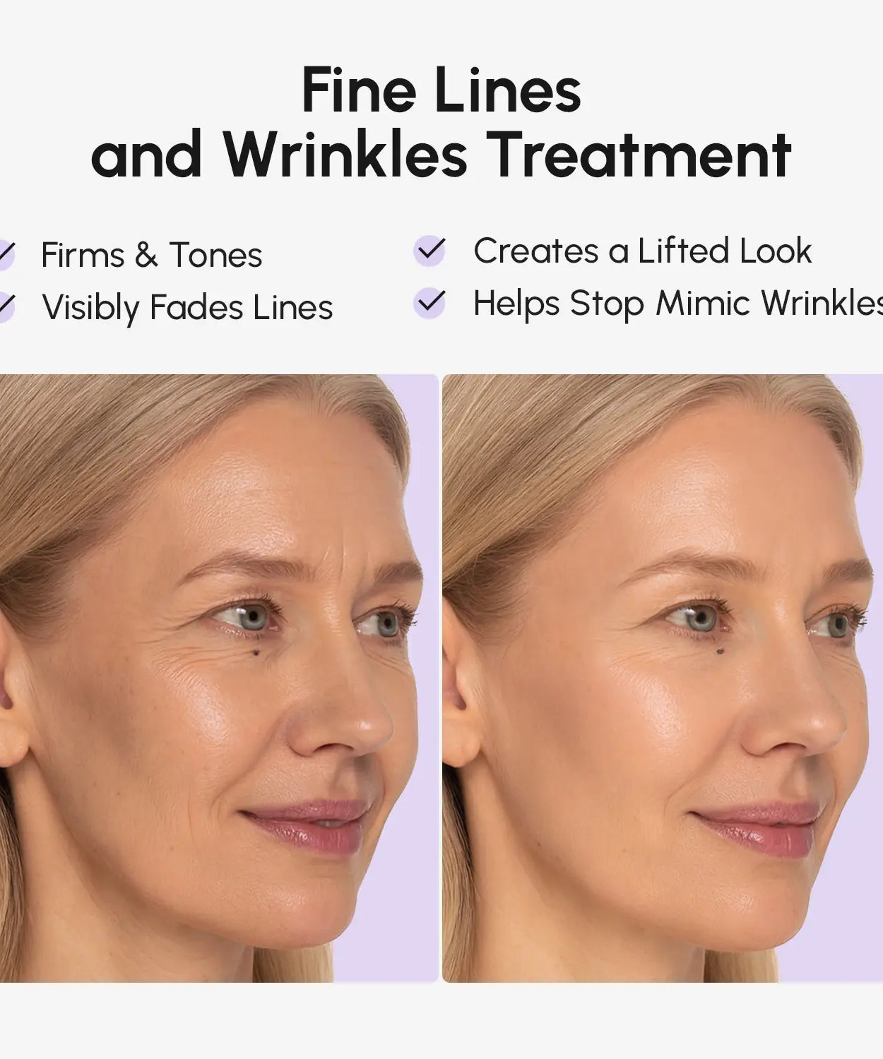 Anti-wrinkle Tape Patches