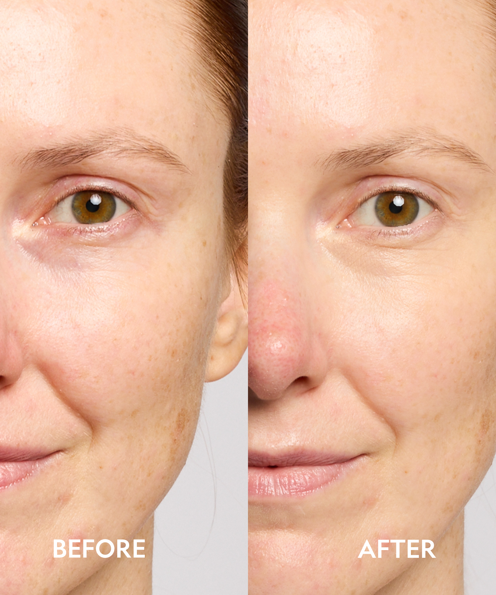 Super Bright Dark Circle Serum Peptide Corrector