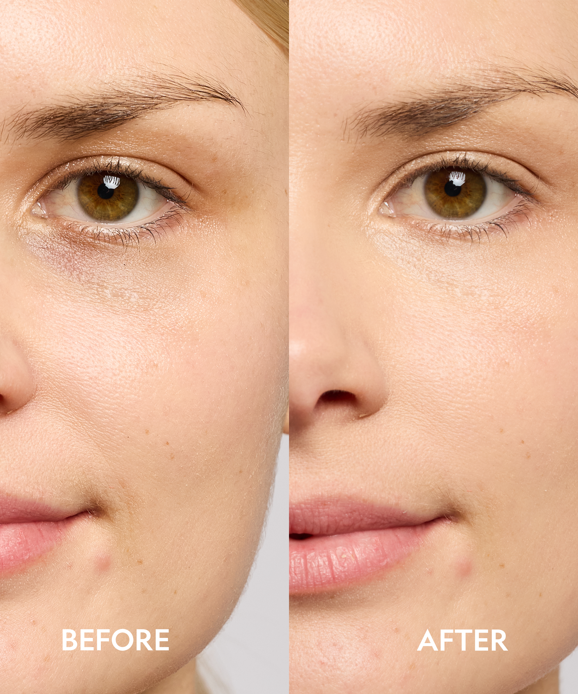 Super Bright Dark Circle Serum Peptide Corrector